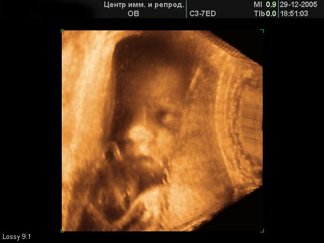 Эмбрион в утробе