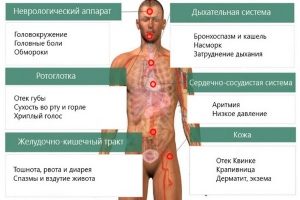 Симптоматика аллергической реакции