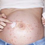 Холистический гепатоз печени при беременности: что это такое?
