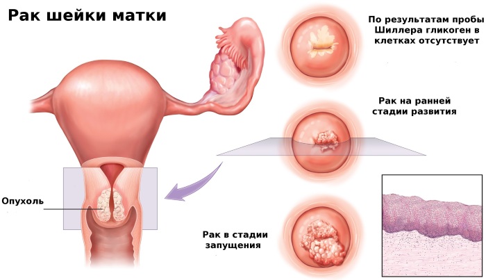 Гистология. Что это такое, как проводится исследование, расшифровка результатов анализа