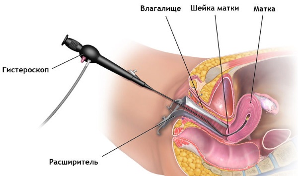 Гистология. Что это такое, как проводится исследование, расшифровка результатов анализа