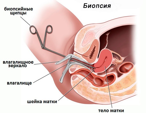 Гистология. Что это такое, как проводится исследование, расшифровка результатов анализа