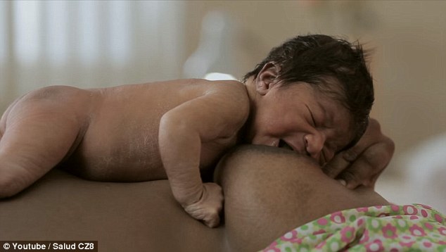World Health Organisation (WHO) recommends breastfeeding within the first half-hour after birth