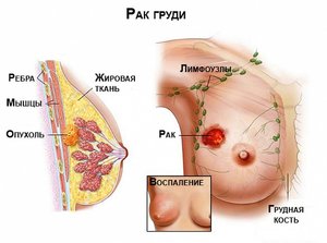 Перечень заболеваний