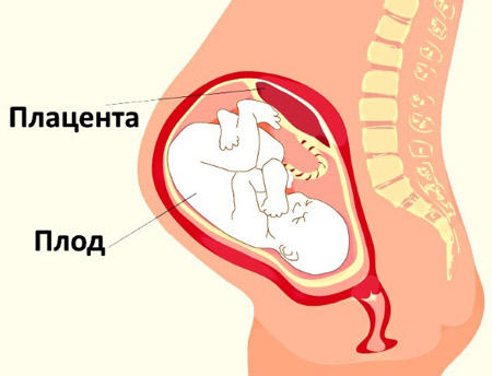 Отслойка плаценты