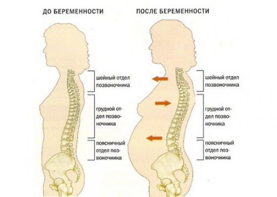 Изменения в позвоночнике при беременности