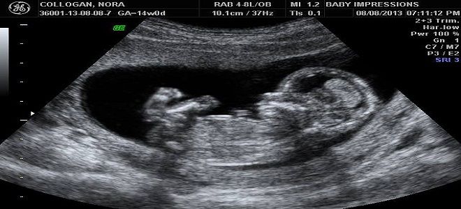 срок беременности 19 недель