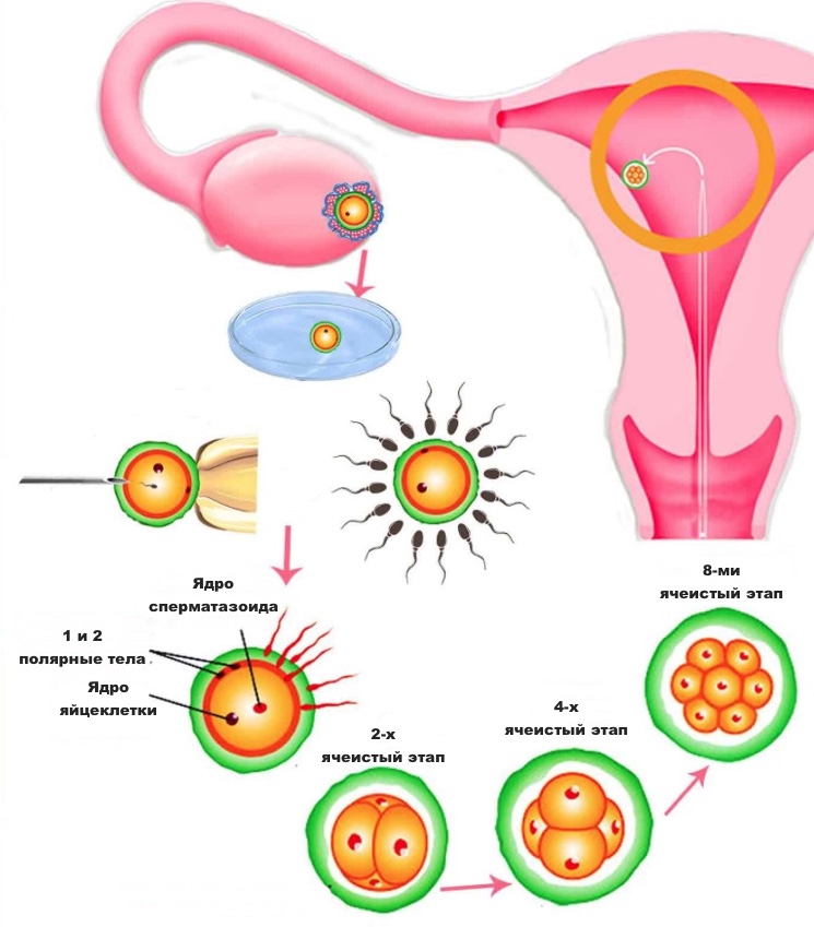 Этапы искусственного оплодотворения